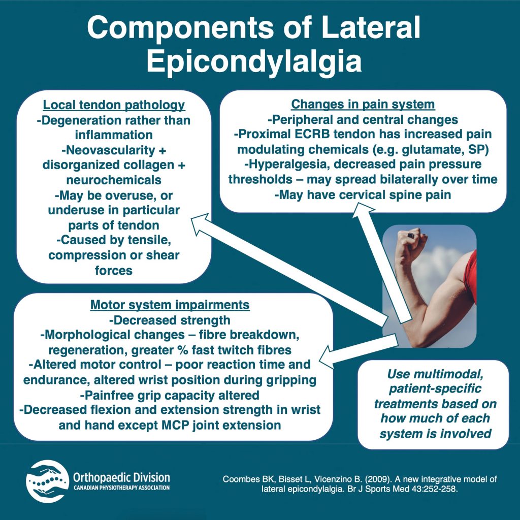 Components of Lateral Epicondylalgia National Orthopaedic Division of the Canadian